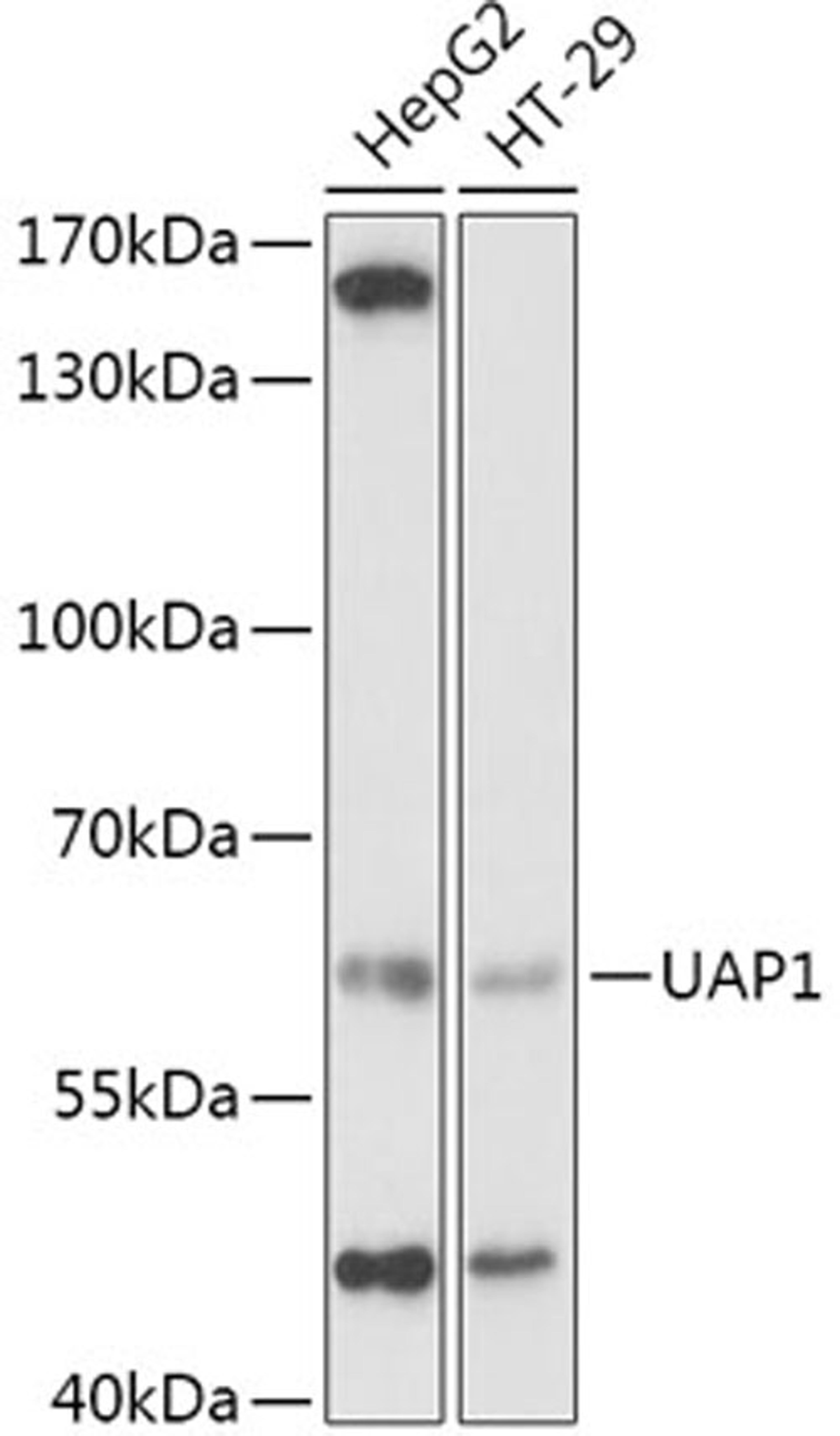 Western blot - UAP1 antibody (A2119)