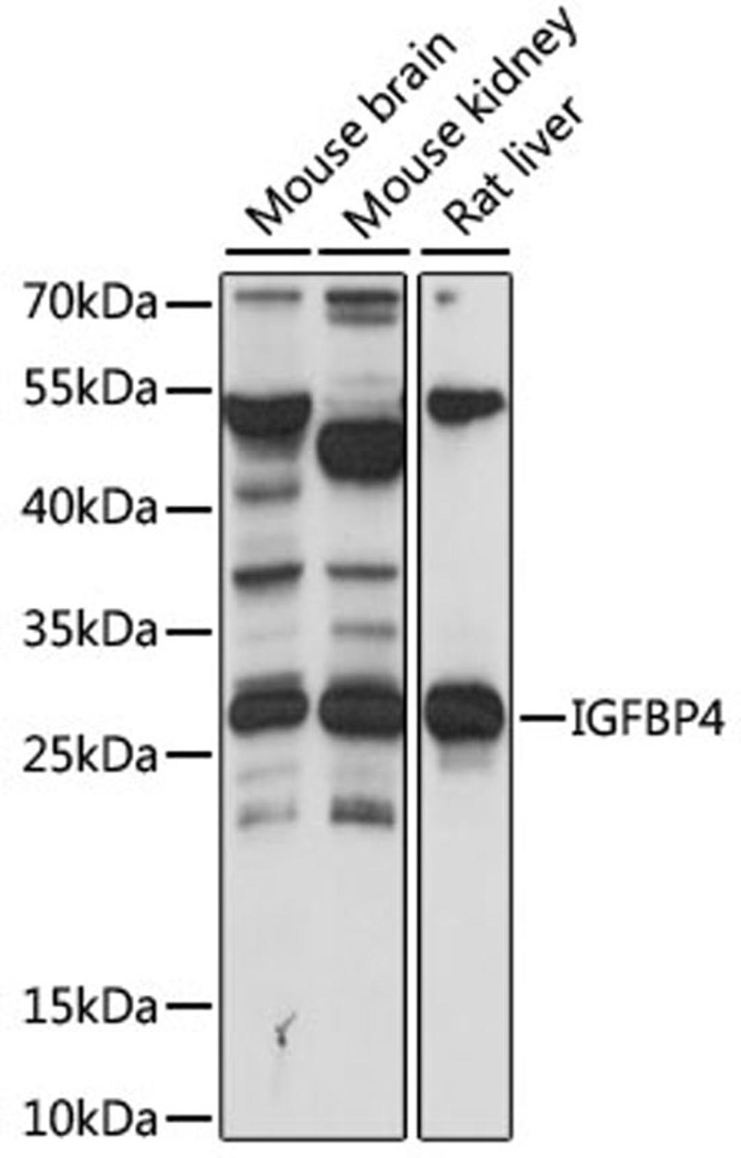 Western blot - IGFBP4 antibody (A15068)