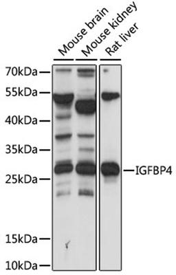 Western blot - IGFBP4 antibody (A15068)