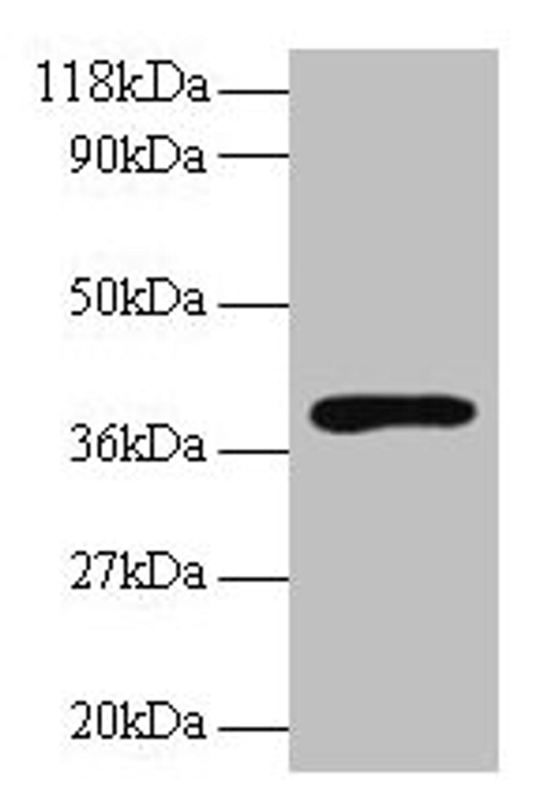 Western blot. All lanes: Hp antibody at 2µg/ml + Rat live tissue. Secondary. Goat polyclonal to rabbit IgG at 1/10000 dilution. Predicted band size: 39, 43 kDa. Observed band size: 39 kDa