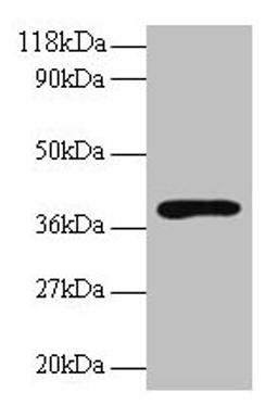 Western blot. All lanes: Hp antibody at 2µg/ml + Rat live tissue. Secondary. Goat polyclonal to rabbit IgG at 1/10000 dilution. Predicted band size: 39, 43 kDa. Observed band size: 39 kDa