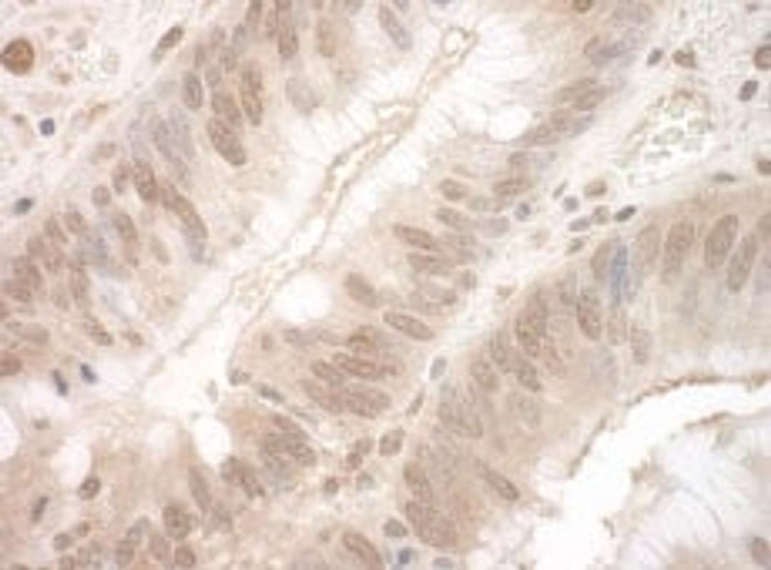 Detection of human EYA3 by immunohistochemistry.