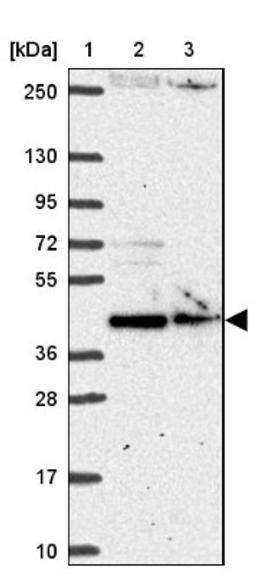 Western Blot: XPE/DDB2 Antibody [NBP2-38854] - Lane 1: Marker [kDa] 250, 130, 95, 72, 55, 36, 28, 17, 10<br/>Lane 2: RT-4<br/>Lane 3: U-251 MG