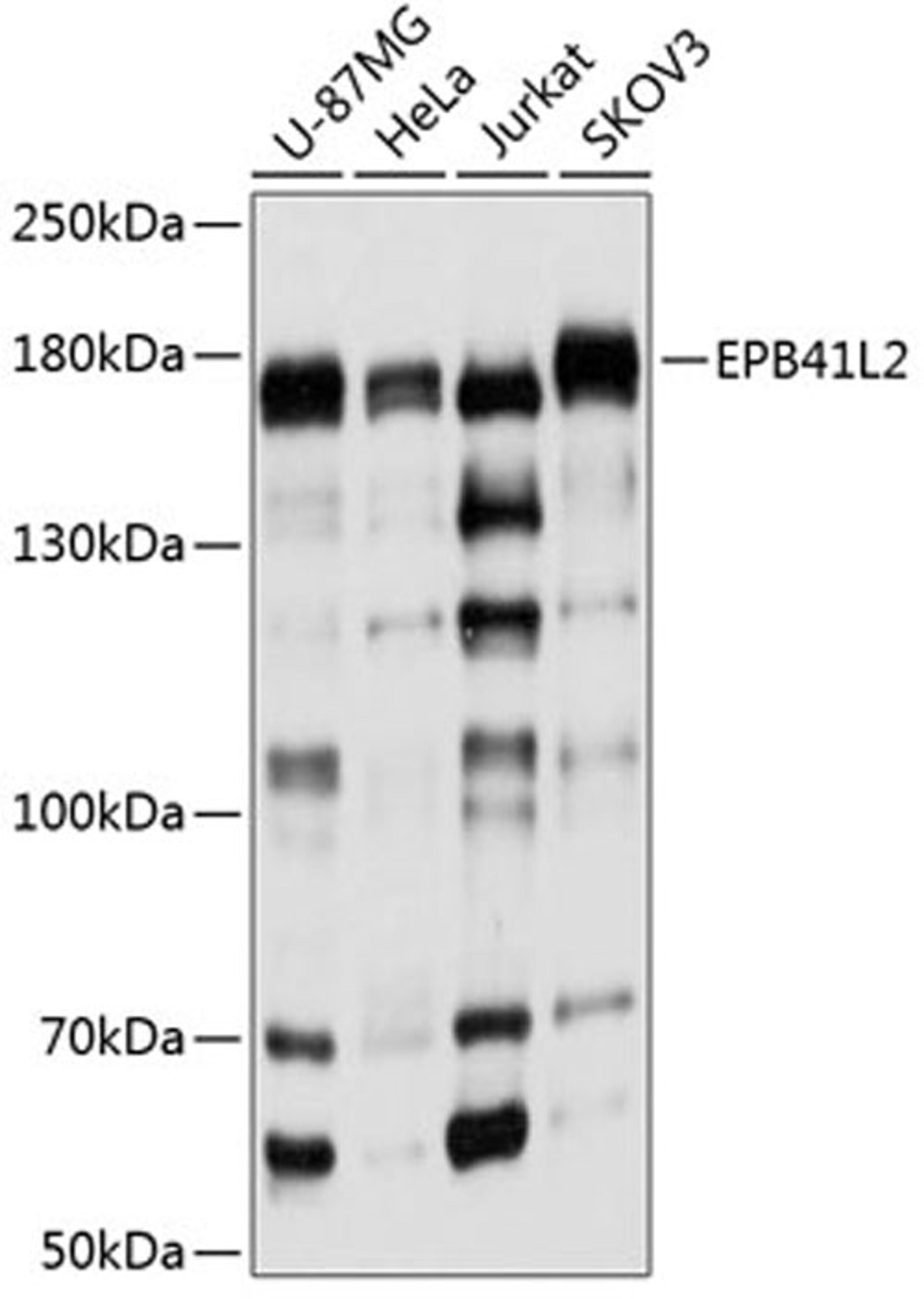 Western blot - EPB41L2 antibody (A9101)