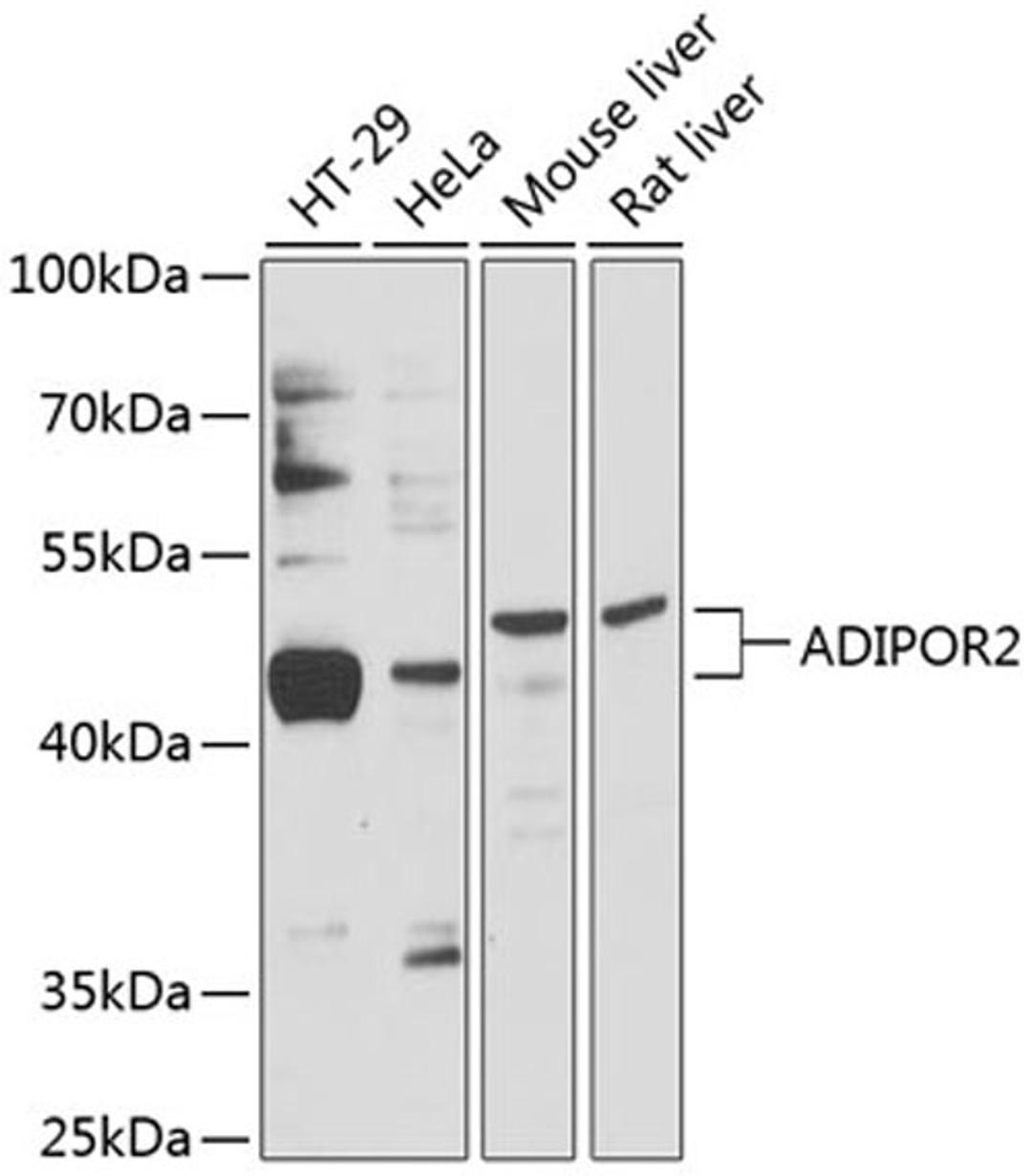 Western blot - ADIPOR2 antibody (A12777)