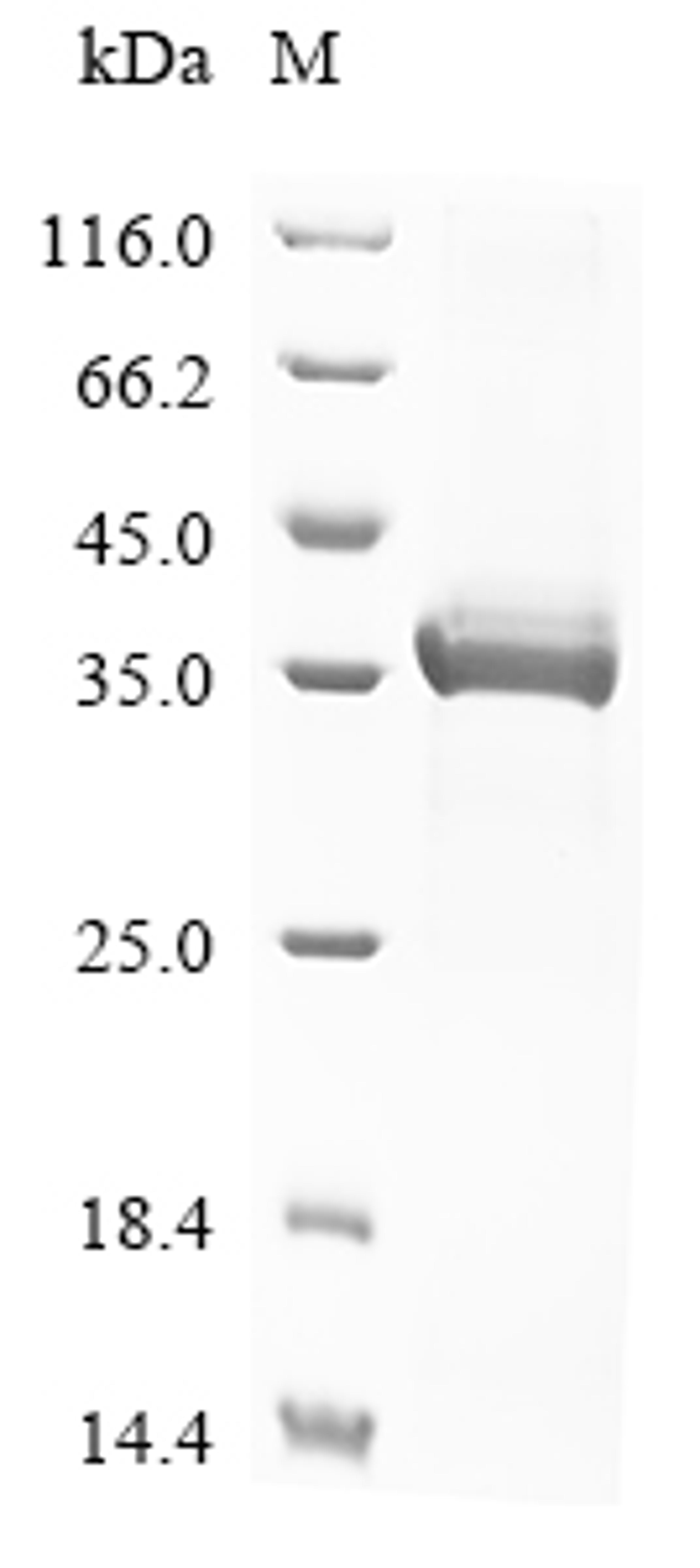 (Tris-Glycine gel) Discontinuous SDS-PAGE (reduced) with 5% enrichment gel and 15% separation gel.