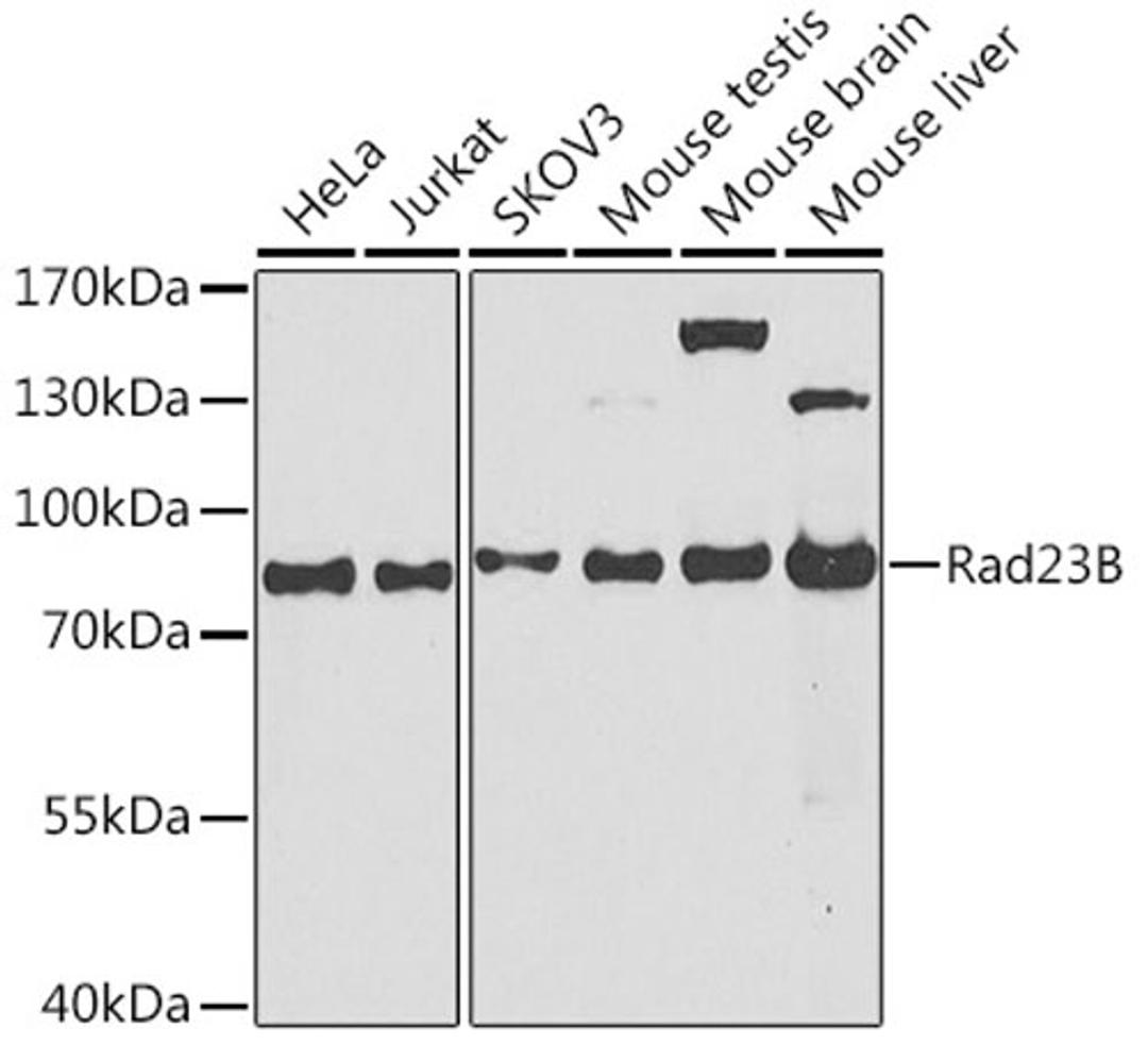 Western blot - Rad23B antibody (A1034)