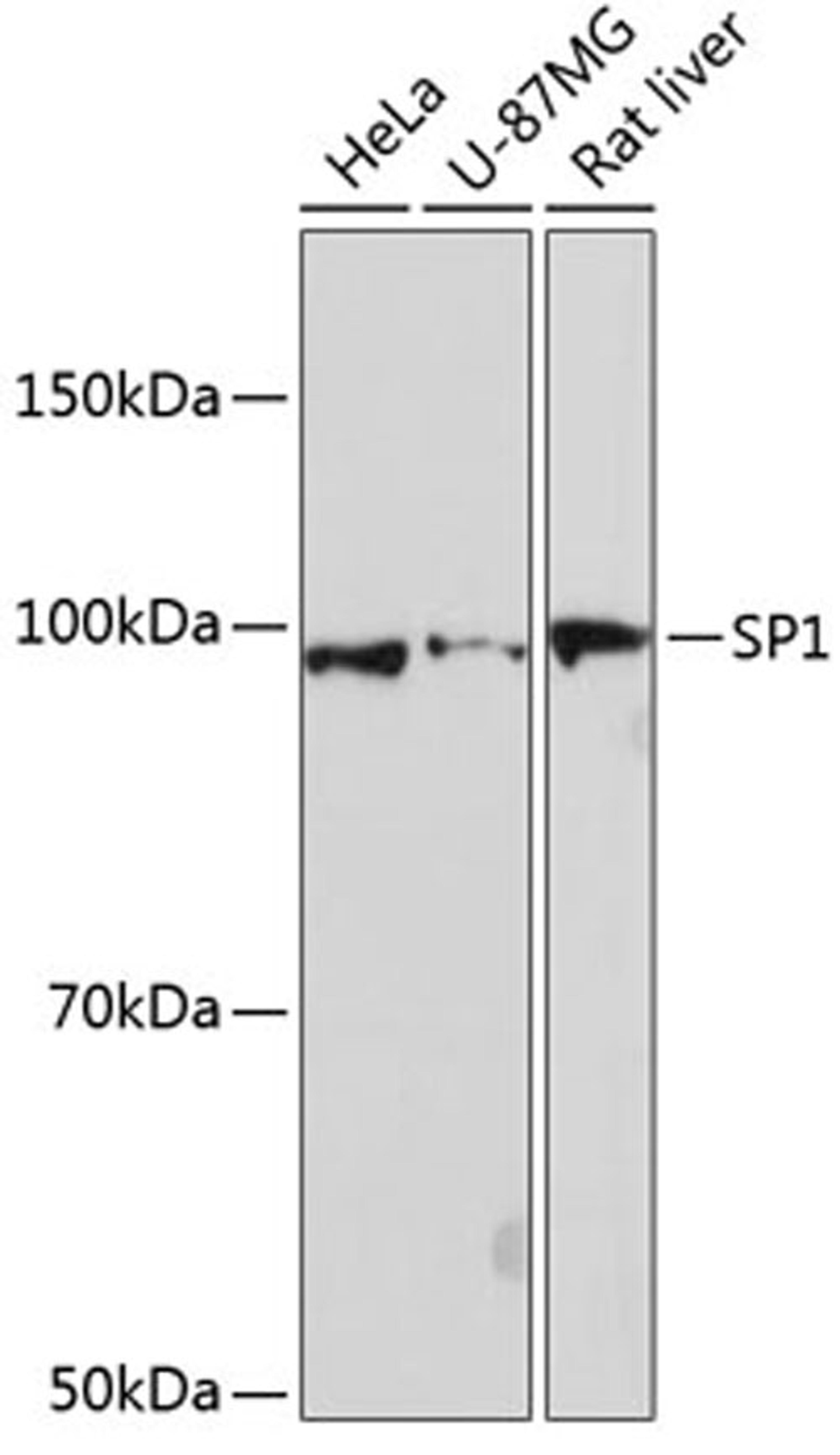 Western blot - SP1 antibody (A19649)