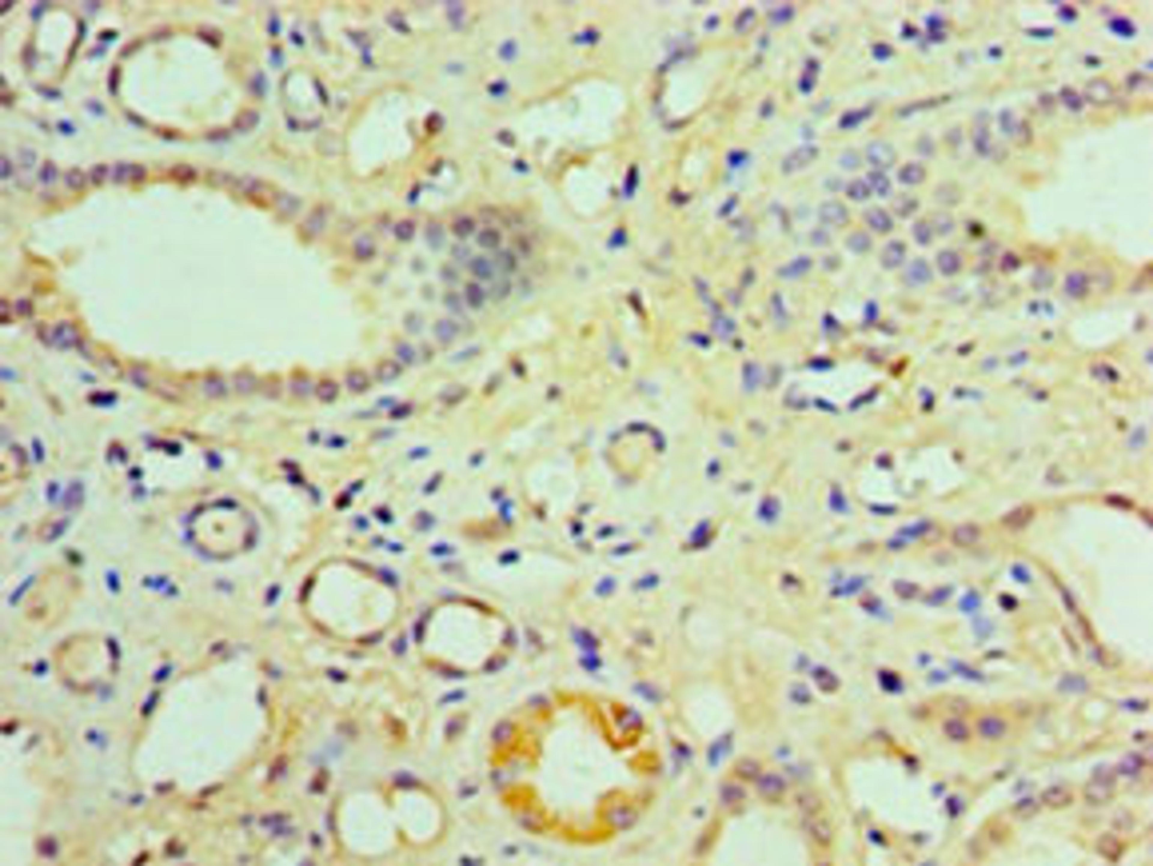 Immunohistochemistry of paraffin-embedded human kidney tissue using CSB-PA13019A0Rb at dilution of 1:100