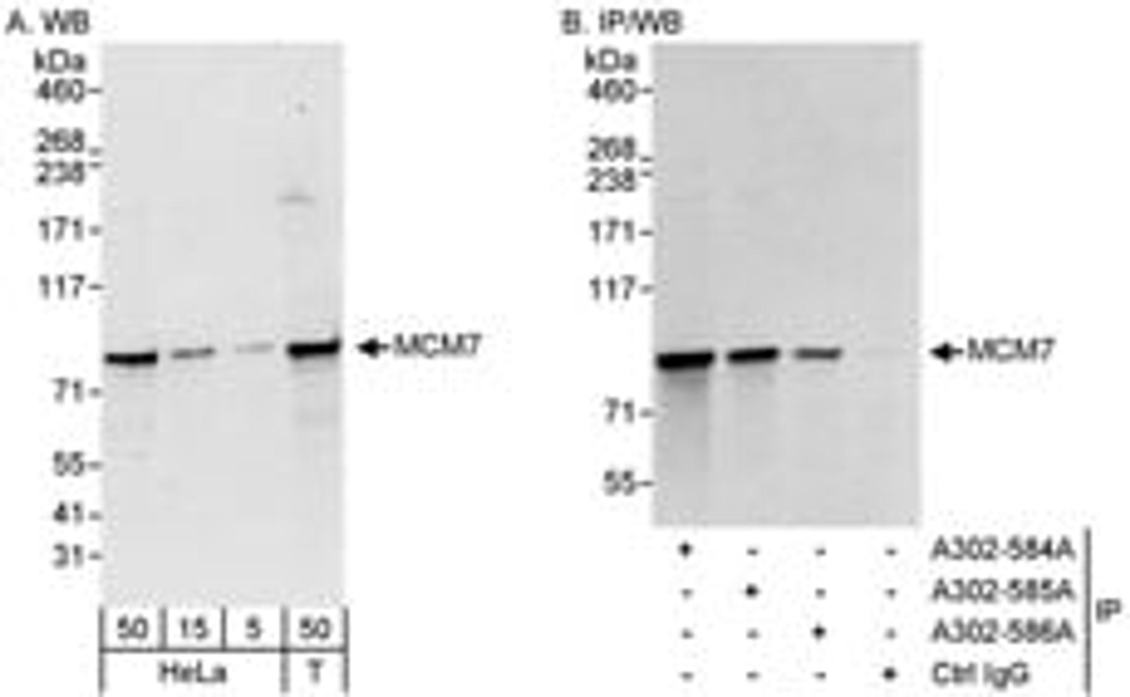 Detection of human MCM7 by western blot and immunoprecipitation.