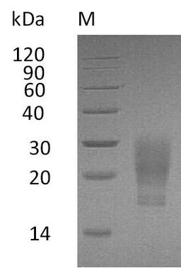 (Tris-Glycine gel) Discontinuous SDS-PAGE (reduced) with 5% enrichment gel and 15% separation gel.