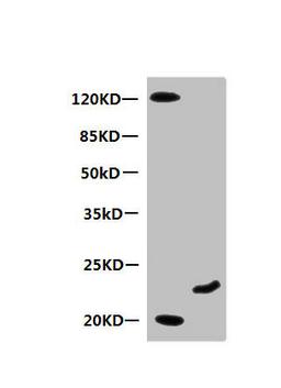 Western Blot. All lanes: Mouse anti-Human Myoglobin monoclonal antibody at 0.3µg/ml. Lane 1: Mouse heart muscle lysate. Lane 2: Recombinant Myoglobin at 10µg. Secondary HRP labeled Goat polyclonal to Mouse IgG at 1/3000 dilution. Predicted band size: 18 kDa. Observed band size: 20 kDa. Additional bands at: 120 kDa. 