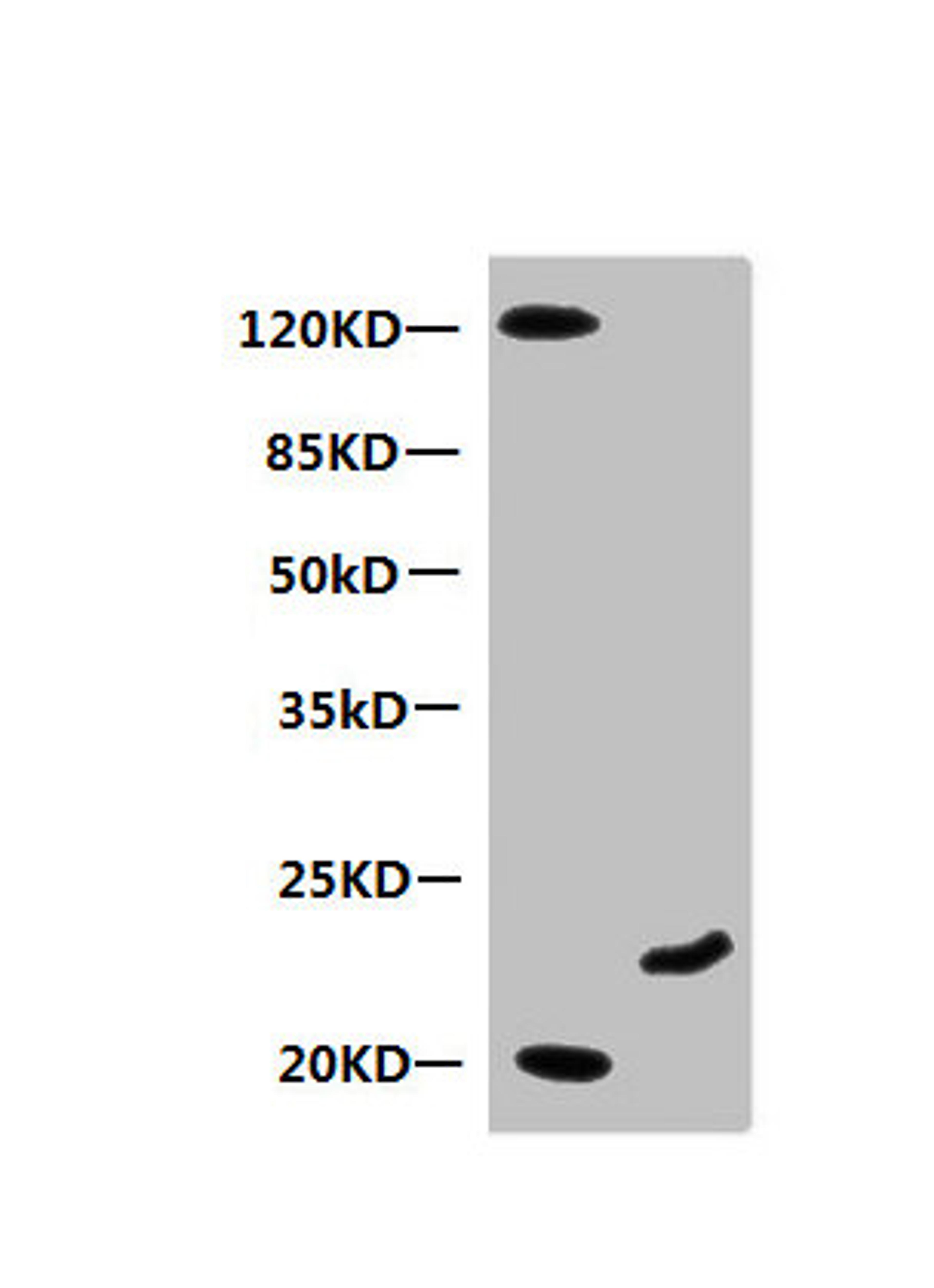 Western Blot. All lanes: Mouse anti-Human Myoglobin monoclonal antibody at 0.3µg/ml. Lane 1: Mouse heart muscle lysate. Lane 2: Recombinant Myoglobin at 10µg. Secondary HRP labeled Goat polyclonal to Mouse IgG at 1/3000 dilution. Predicted band size: 18 kDa. Observed band size: 20 kDa. Additional bands at: 120 kDa. 