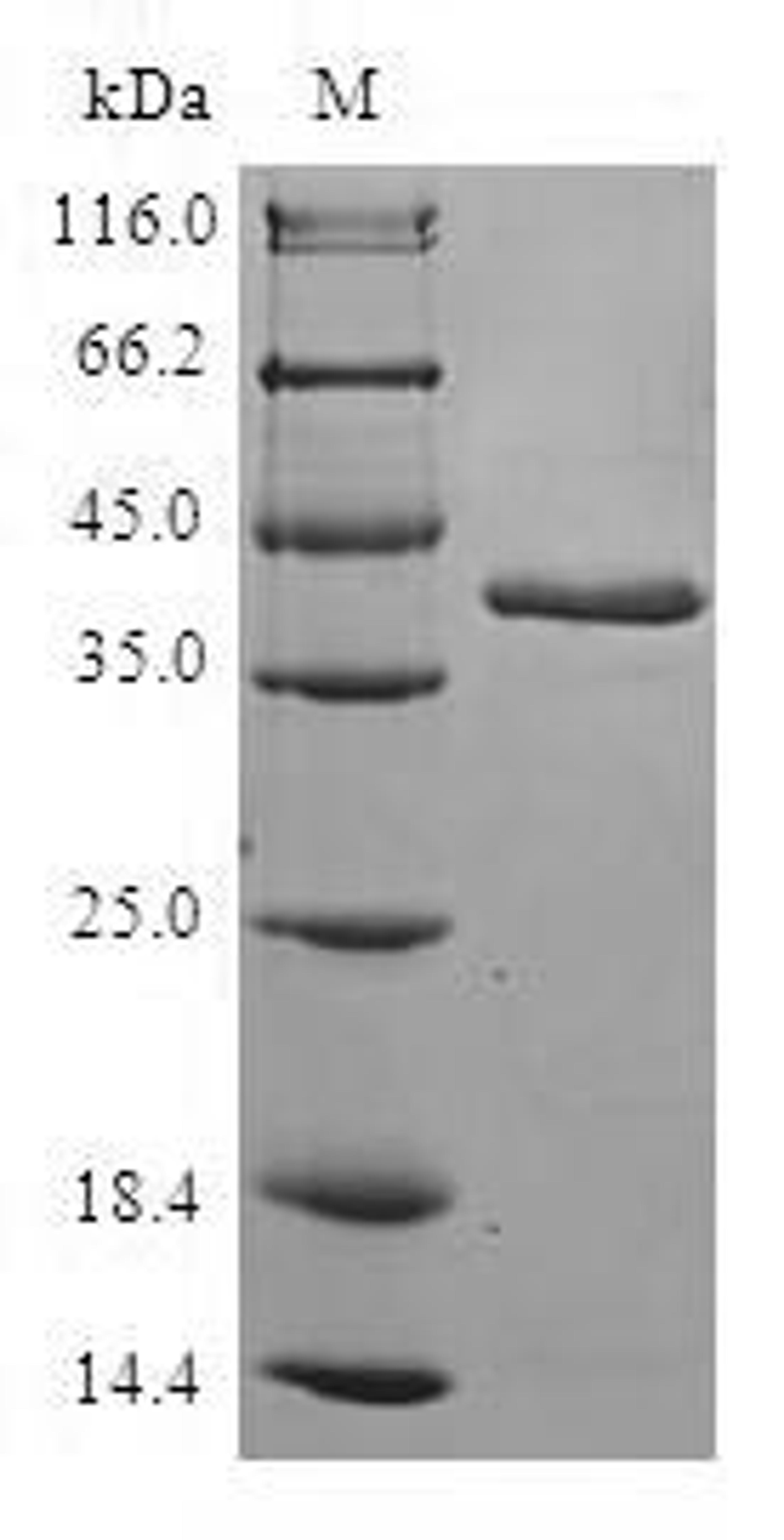 (Tris-Glycine gel) Discontinuous SDS-PAGE (reduced) with 5% enrichment gel and 15% separation gel.