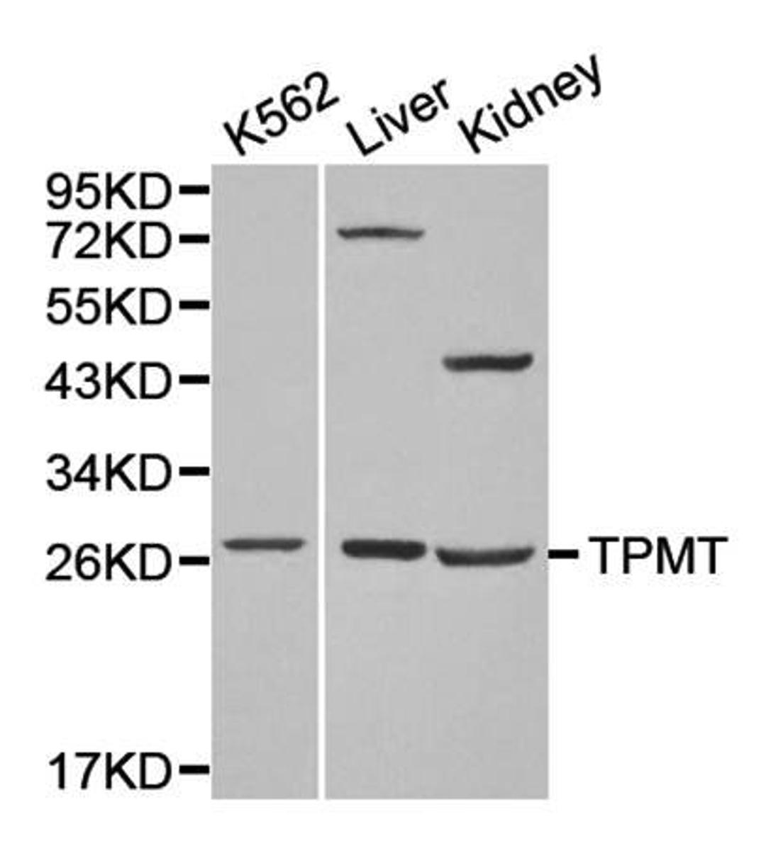 Western blot analysis of K562,Liver,Kidney cell line lysates using TPMT antibody