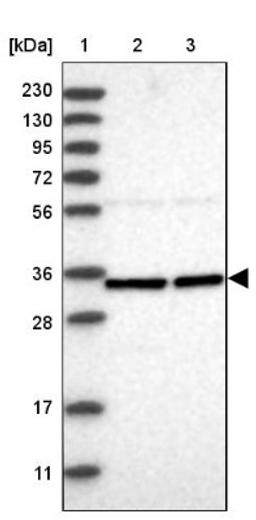 Western Blot: ZNF124 Antibody [NBP1-81634] - Lane 1: Marker [kDa] 230, 130, 95, 72, 56, 36, 28, 17, 11<br/>Lane 2: Human cell line RT-4<br/>Lane 3: Human cell line U-251MG sp