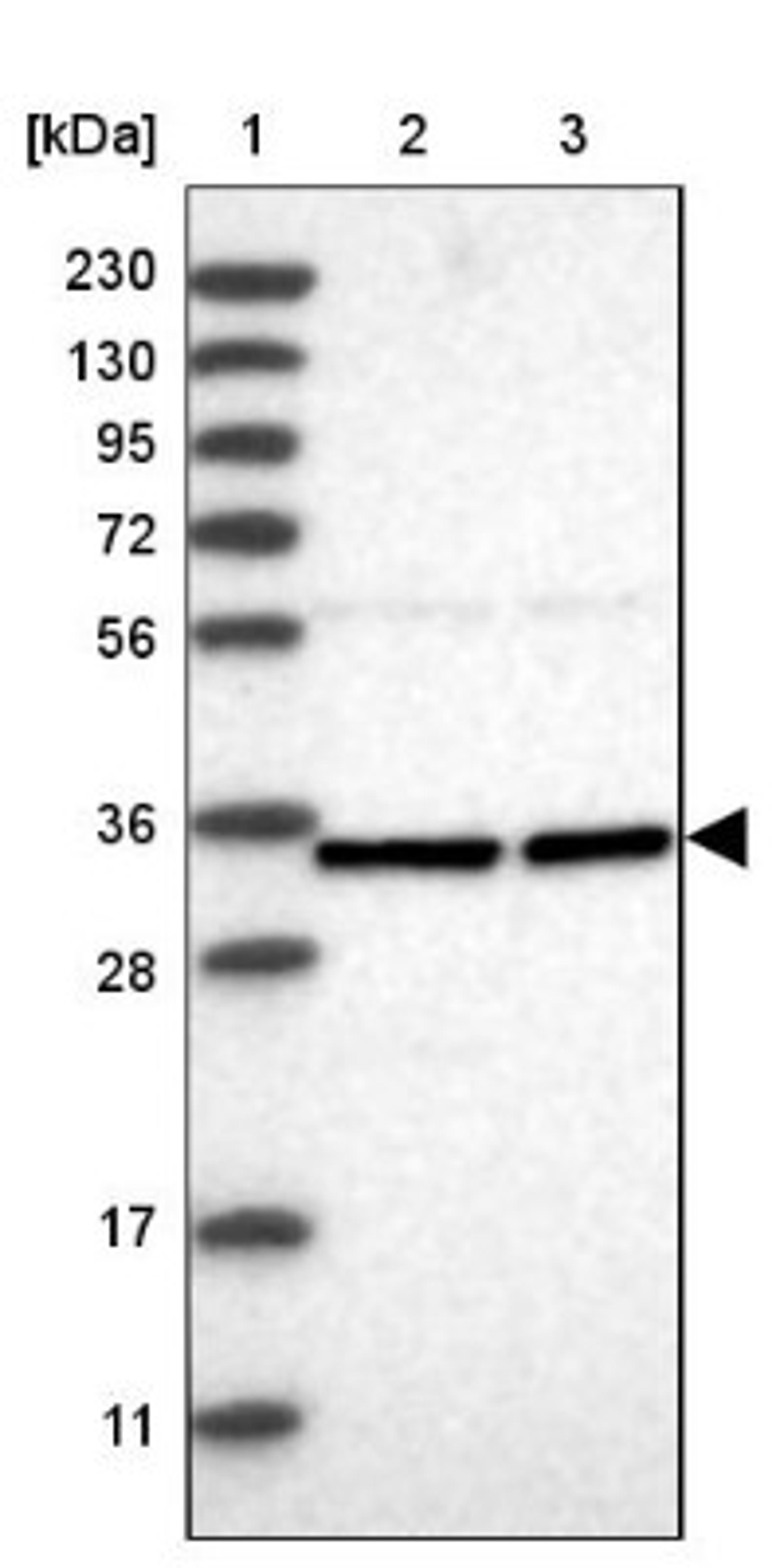 Western Blot: ZNF124 Antibody [NBP1-81634] - Lane 1: Marker [kDa] 230, 130, 95, 72, 56, 36, 28, 17, 11<br/>Lane 2: Human cell line RT-4<br/>Lane 3: Human cell line U-251MG sp