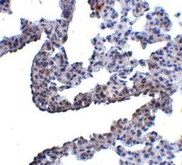 Immunohistochemistry-Paraffin: Protocadherin-12 Antibody [NBP1-77002] - Rat lung tissue with Protocadherin 12 antibody at 5 ug/ml.