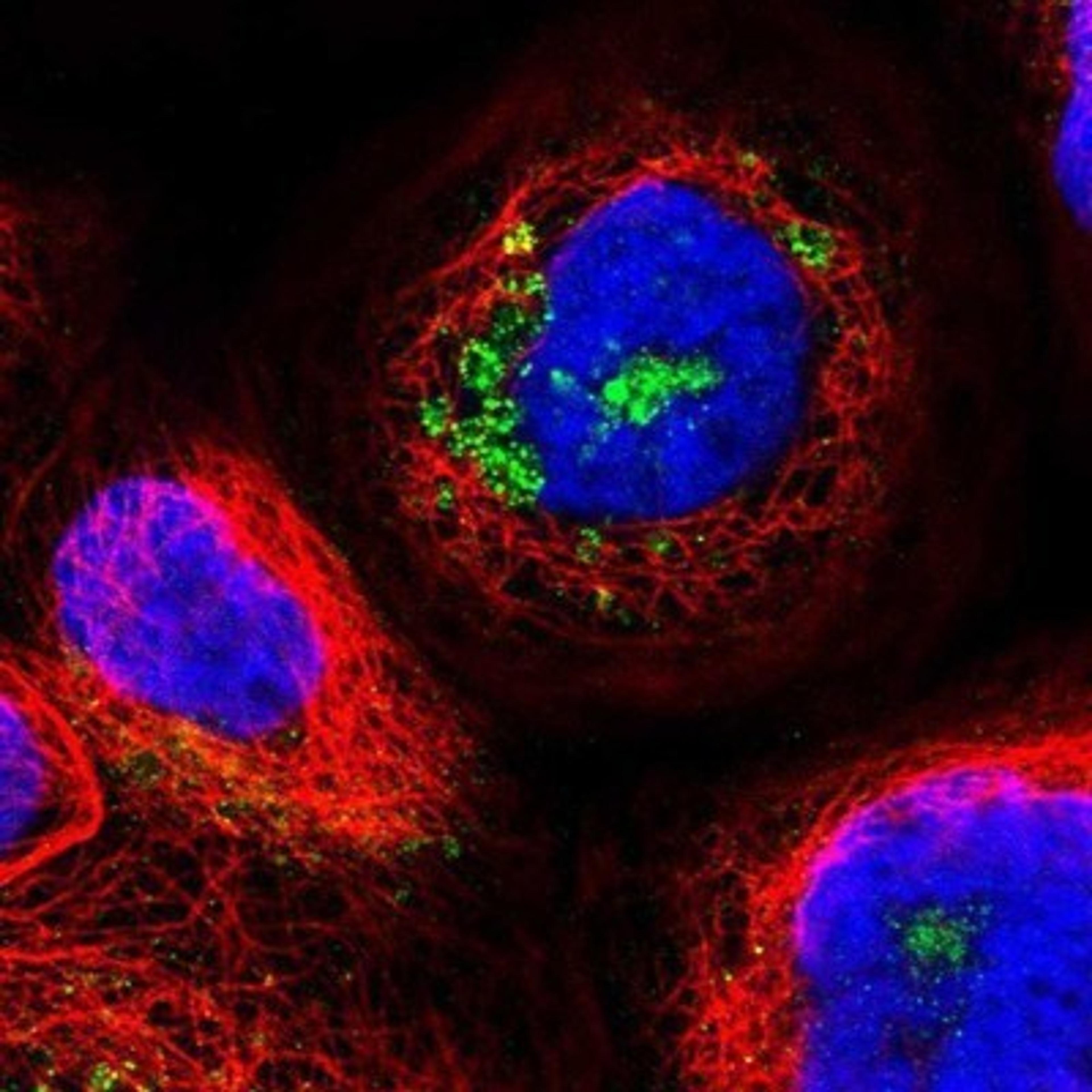 Immunocytochemistry/Immunofluorescence: CCDC155 Antibody [NBP1-81992] - Staining of human cell line A-431 shows positivity in golgi apparatus & vesicles.