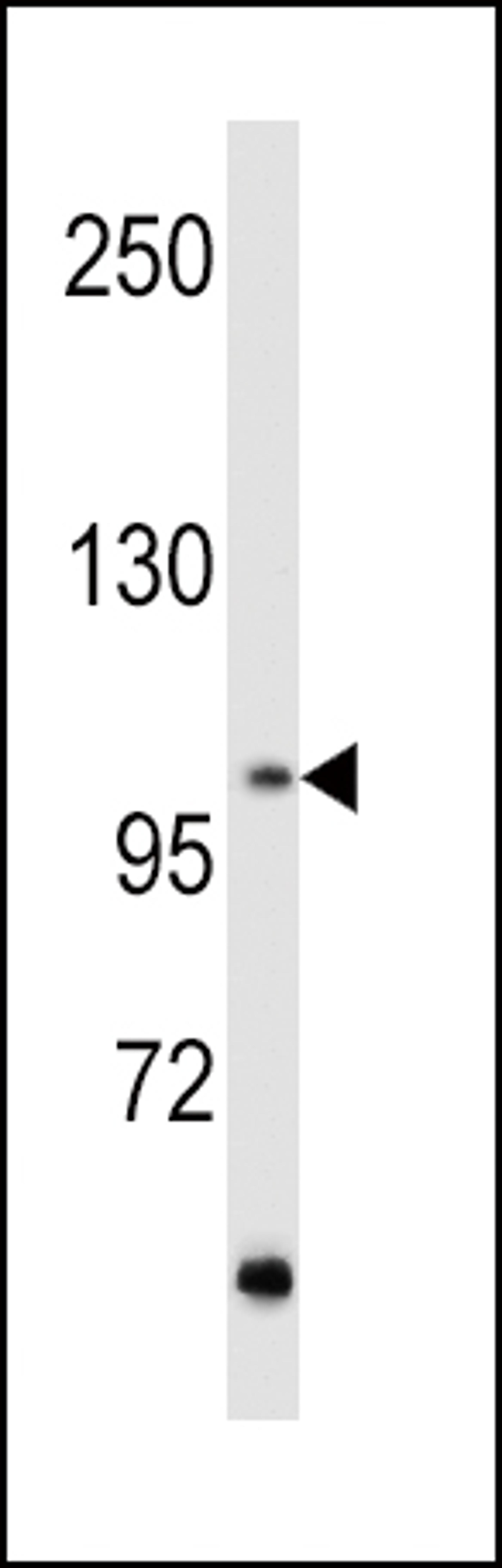 Western blot analysis of hRET-G28 in MCF7 cell line lysates (35ug/lane)