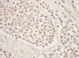 Detection of human SRPK1 by immunohistochemistry.