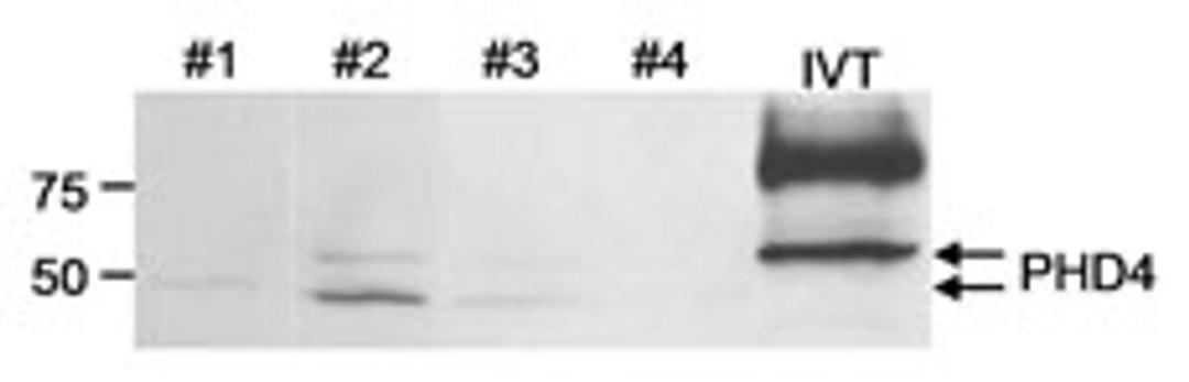 Detection of human PHD4 by western blot.