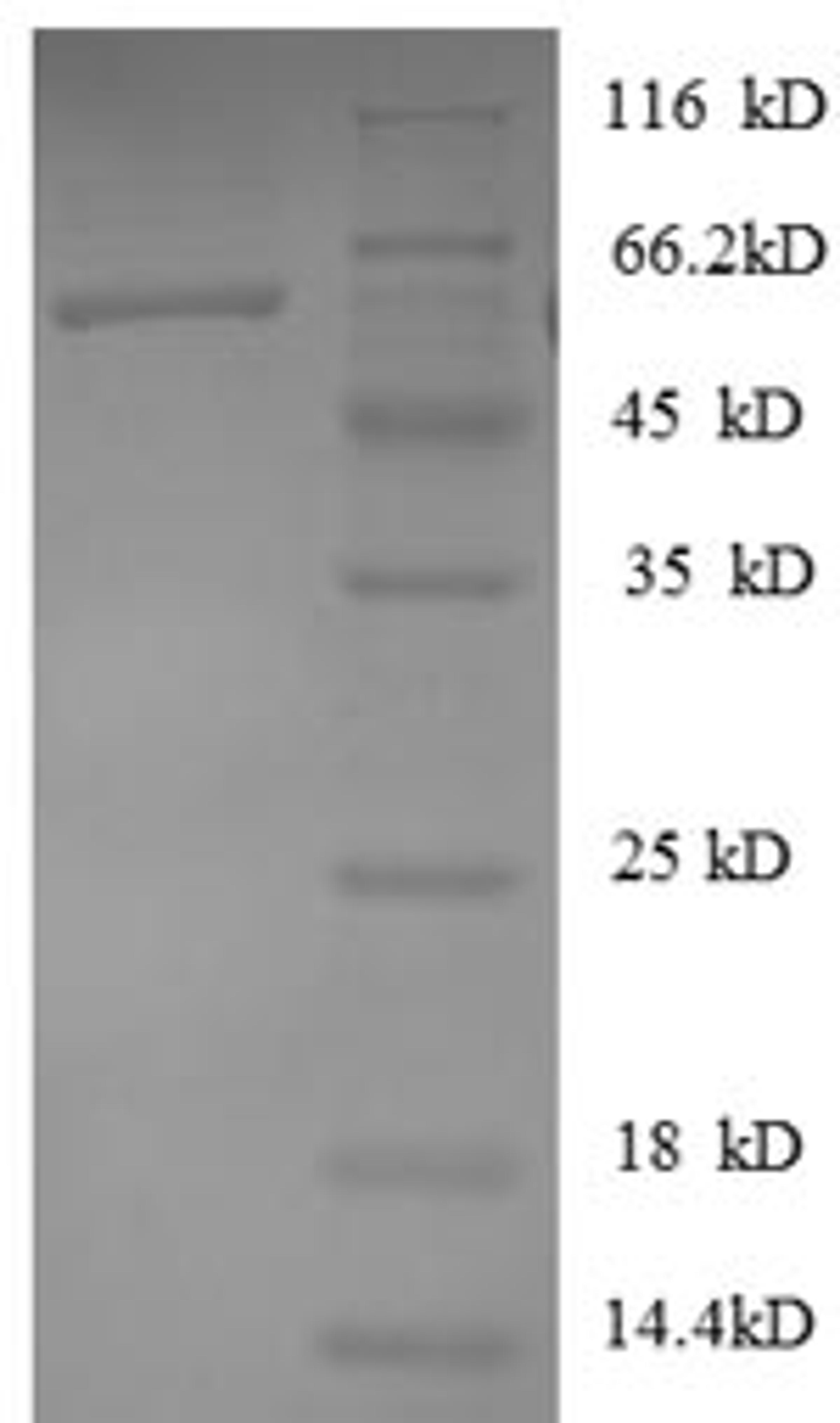 (Tris-Glycine gel) Discontinuous SDS-PAGE (reduced) with 5% enrichment gel and 15% separation gel.