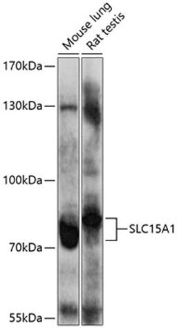 Western blot - SLC15A1 antibody (A10246)