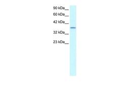 Antibody used in WB on Human Lung at 0.2-1 ug/ml.