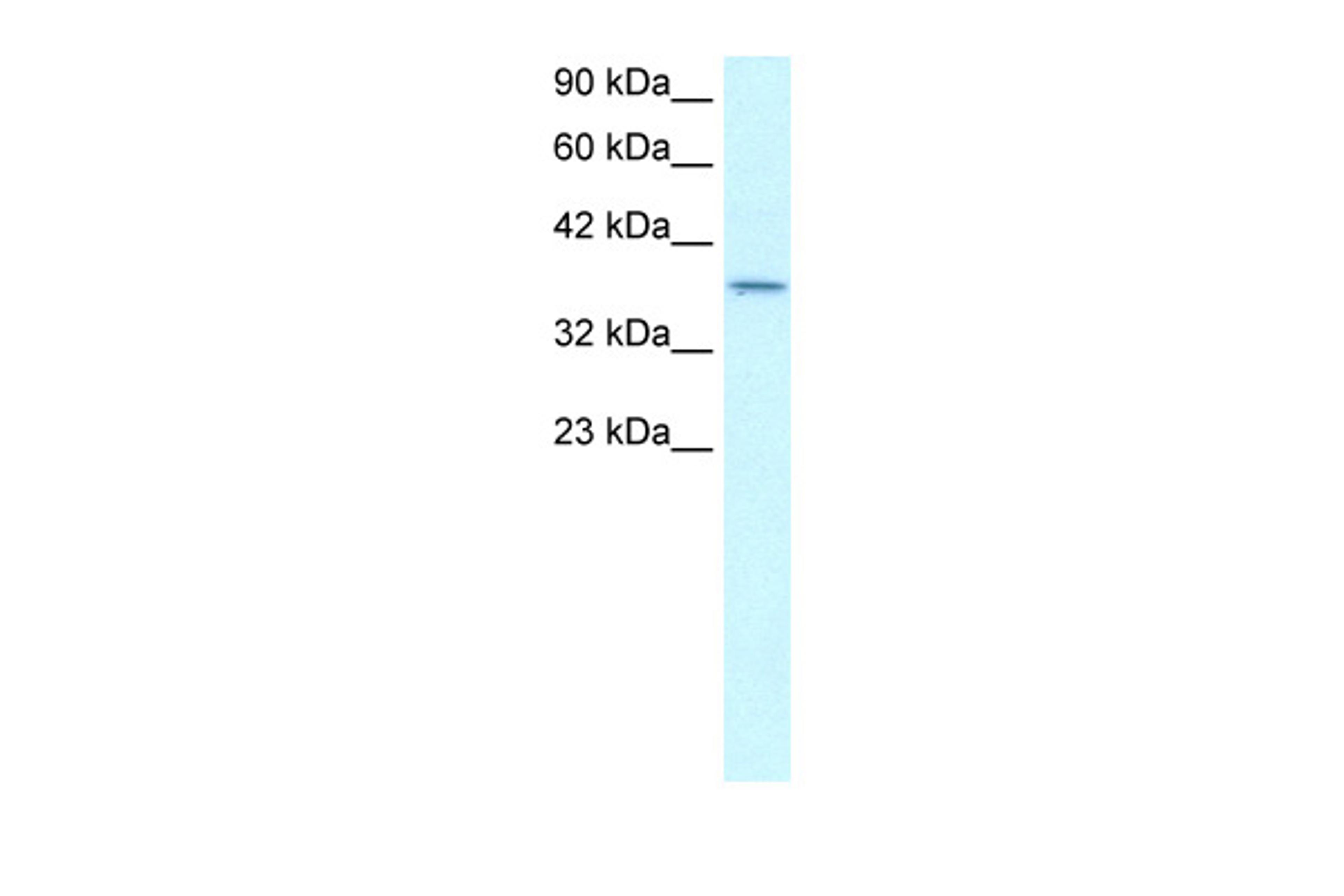 Antibody used in WB on Human Lung at 0.2-1 ug/ml.