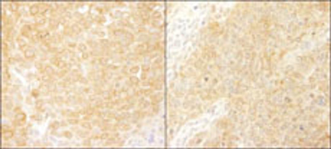 Detection of human and mouse BCAR1/p130CAS by immunohistochemistry.