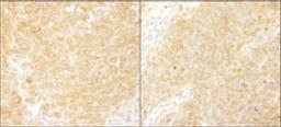 Detection of human and mouse BCAR1/p130CAS by immunohistochemistry.