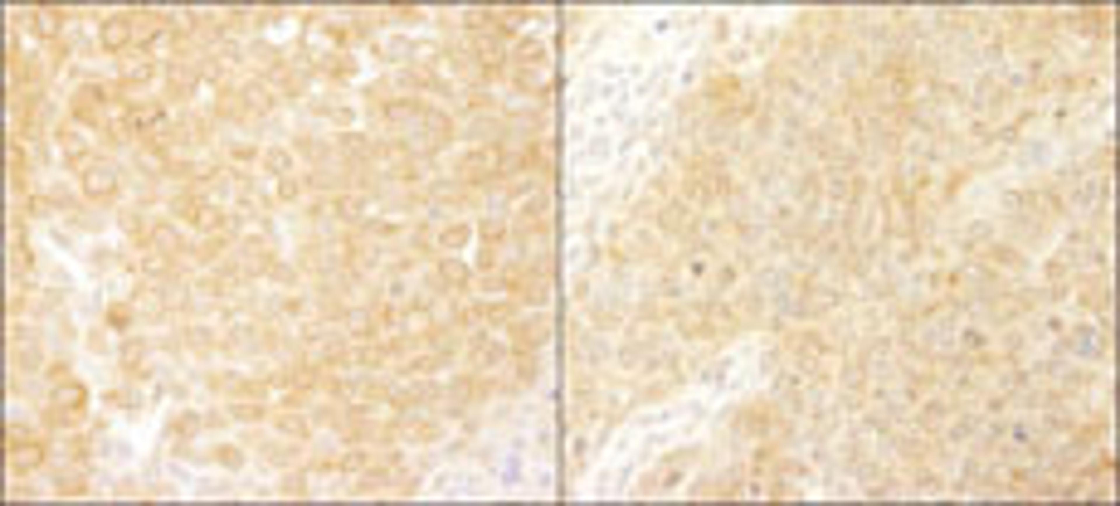 Detection of human and mouse BCAR1/p130CAS by immunohistochemistry.