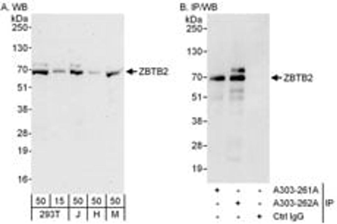 Detection of human and mouse ZBTB2 by western blot (h and m) and immunoprecipitation (h).