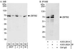 Detection of human and mouse ZBTB2 by western blot (h and m) and immunoprecipitation (h).