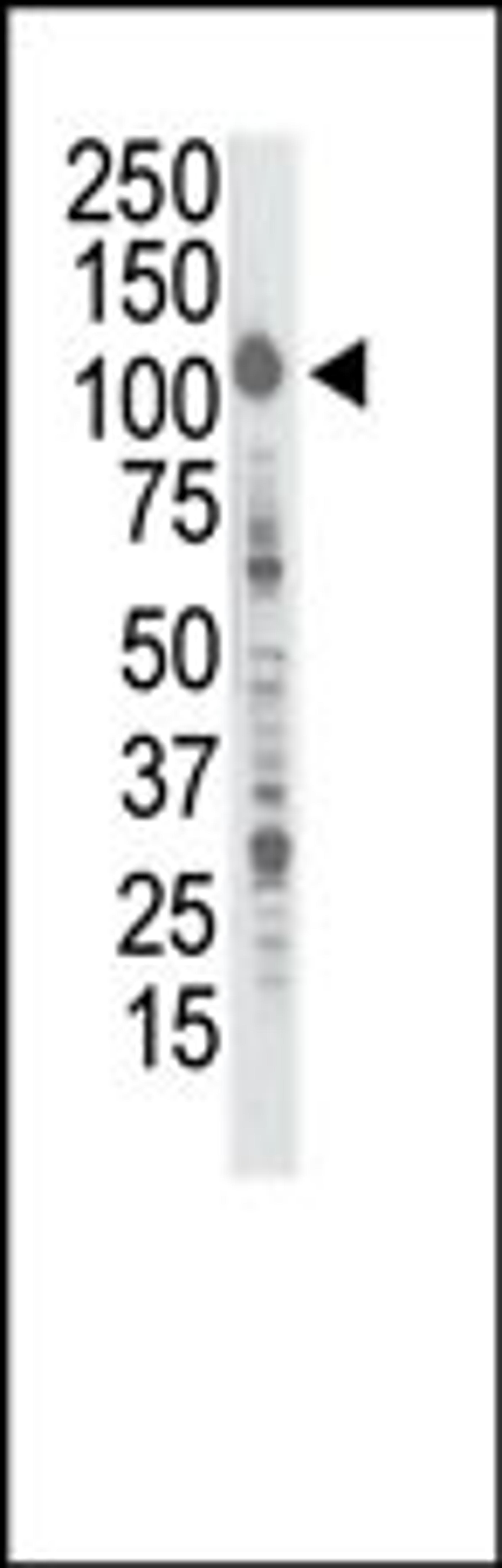 Western blot analysis of anti-InsRR Pab in A375 cell lysate. Lane A: preimmune, Lane B: purified antibody