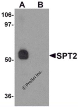 Western blot analysis of SPT2 in 3T3 cell lysate with SPT2 antibody at 0.5 &#956;g/mL in (A) the absence and (B) the presence of blocking peptide.