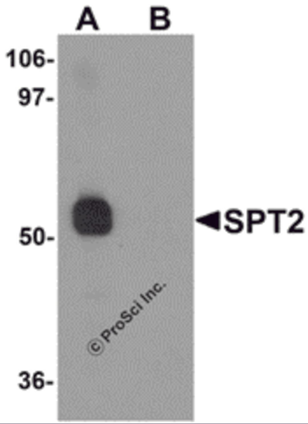 Western blot analysis of SPT2 in 3T3 cell lysate with SPT2 antibody at 0.5 μg/mL in (A) the absence and (B) the presence of blocking peptide.