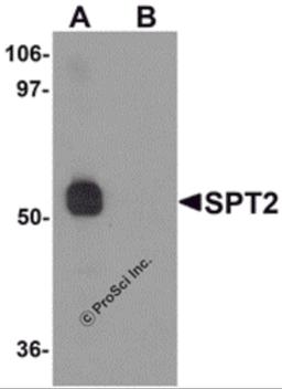 Western blot analysis of SPT2 in 3T3 cell lysate with SPT2 antibody at 0.5 μg/mL in (A) the absence and (B) the presence of blocking peptide.