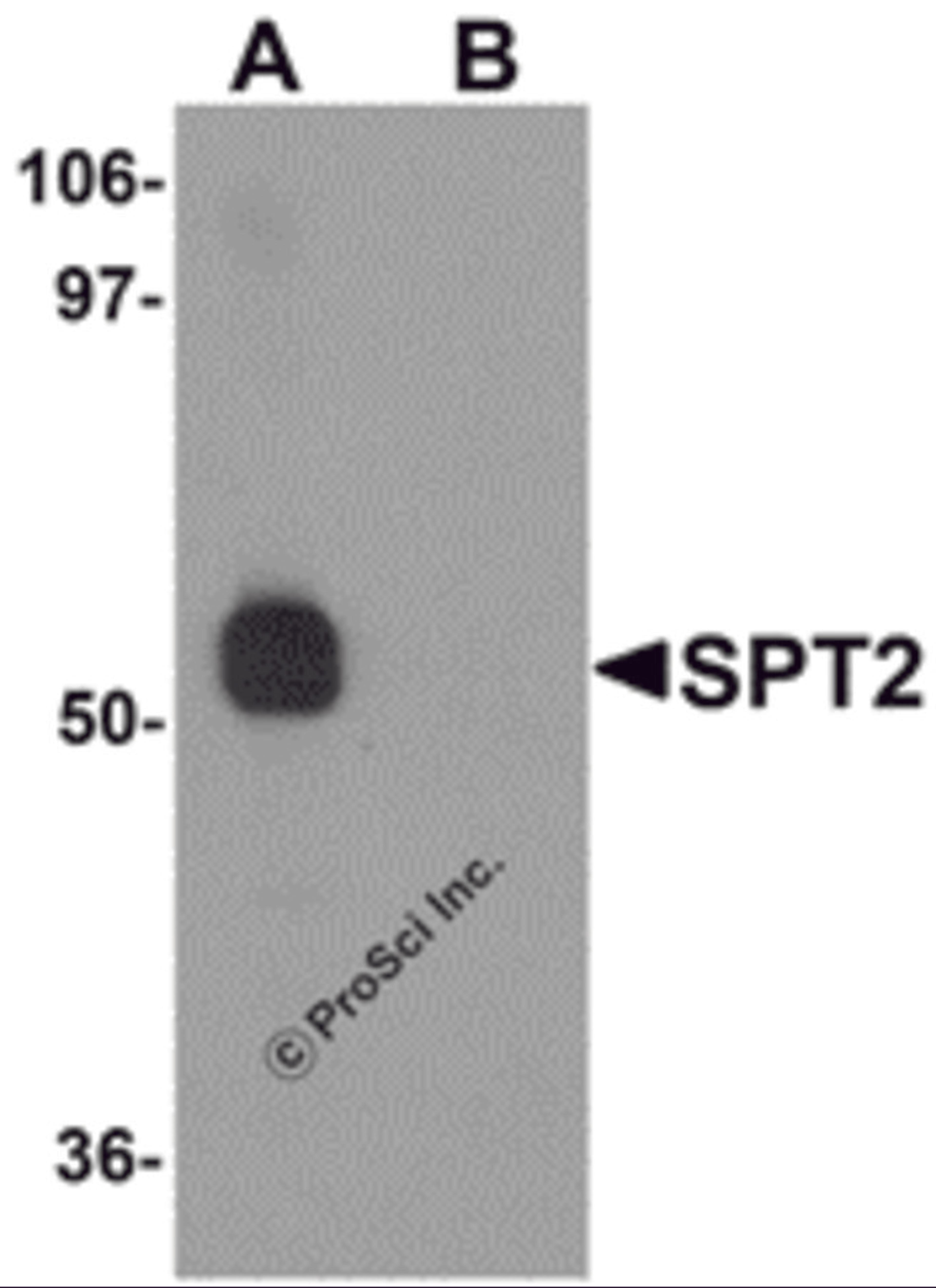 Western blot analysis of SPT2 in 3T3 cell lysate with SPT2 antibody at 0.5 μg/mL in (A) the absence and (B) the presence of blocking peptide.