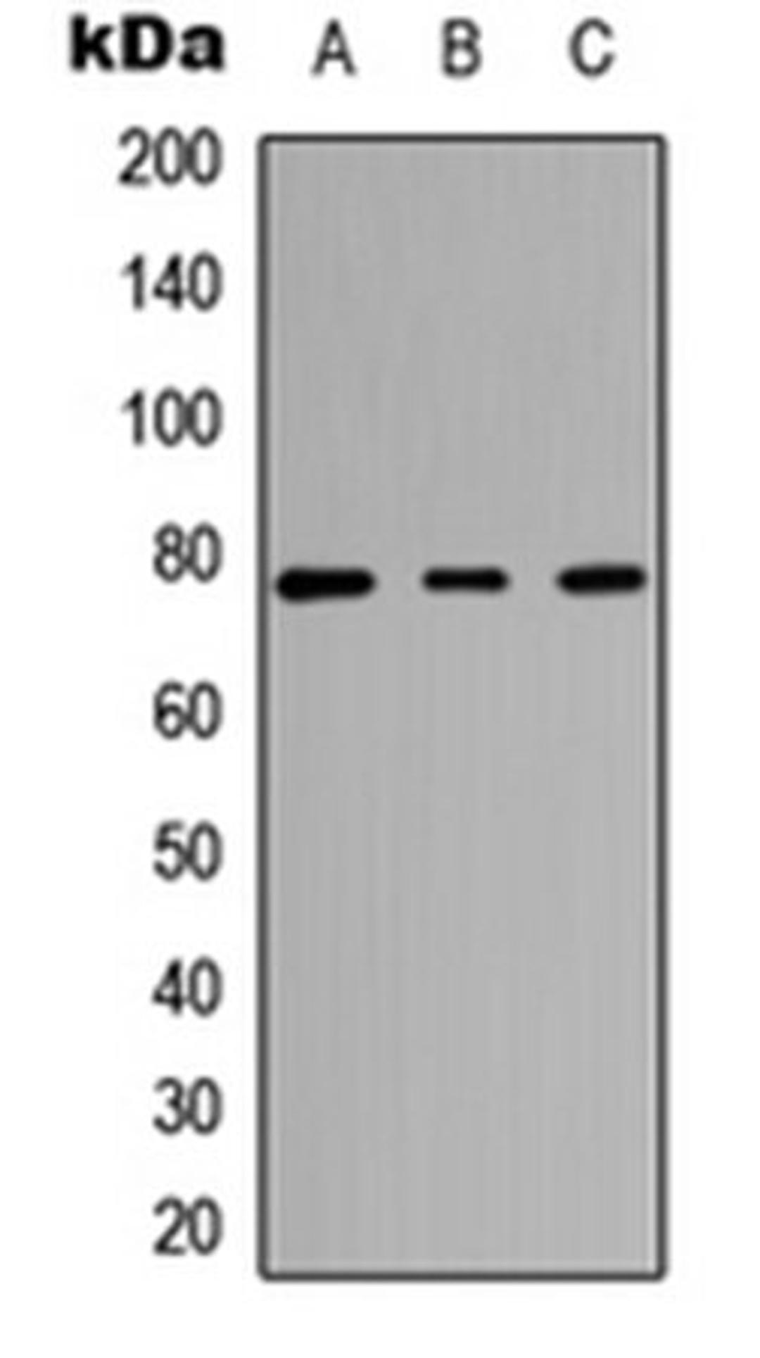 Western blot analysis of HEK293T (Lane 1), Raw264.7 (Lane 2), H9C2 (Lane 3) whole cell lysates using CARK antibody