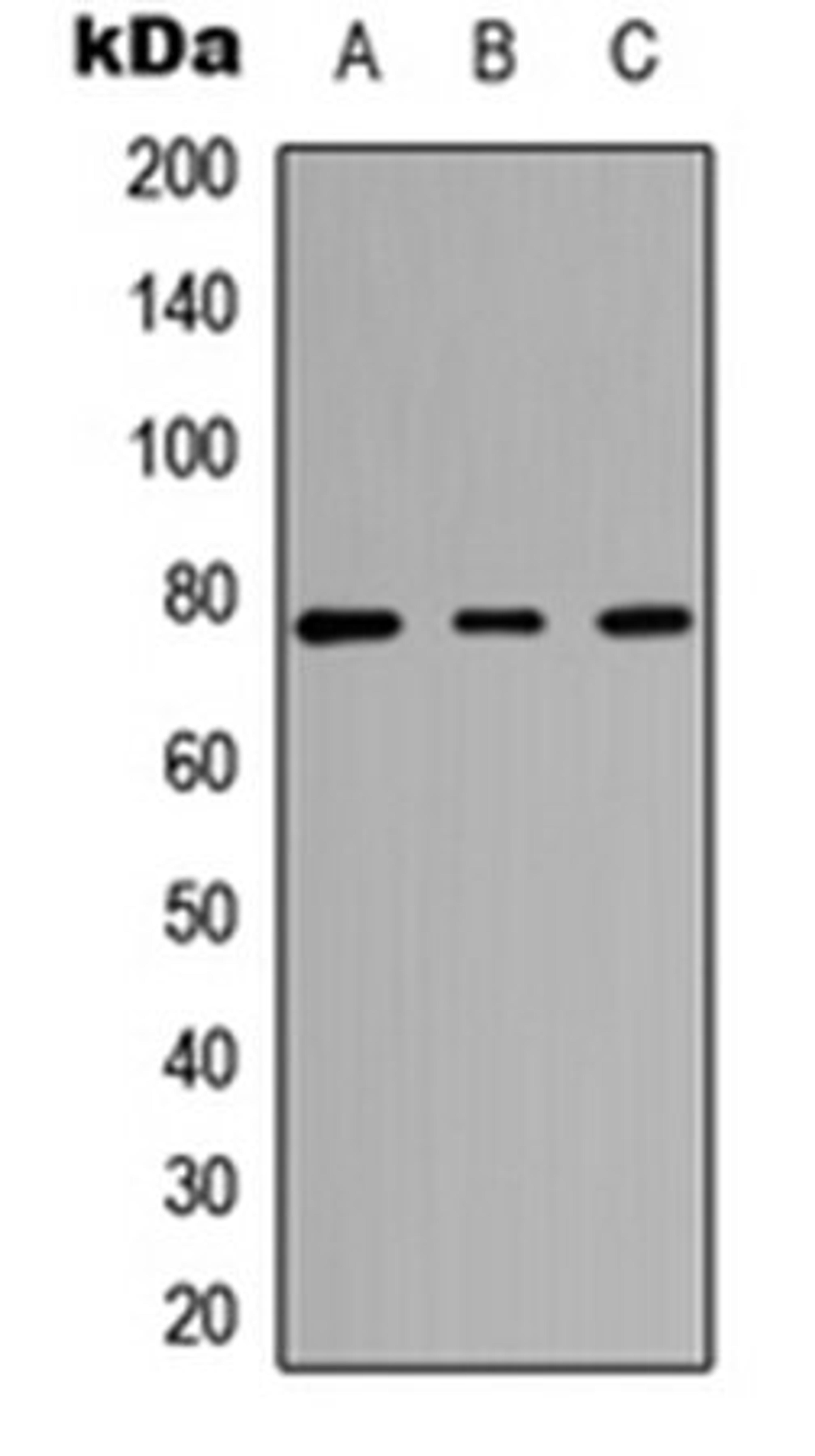 Western blot analysis of HEK293T (Lane 1), Raw264.7 (Lane 2), H9C2 (Lane 3) whole cell lysates using CARK antibody