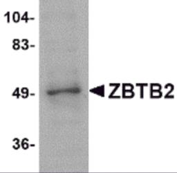 Western blot analysis of ZBTB2 in PC-3 cell lysate with ZBTB2 antibody at 1 &#956;g/mL.