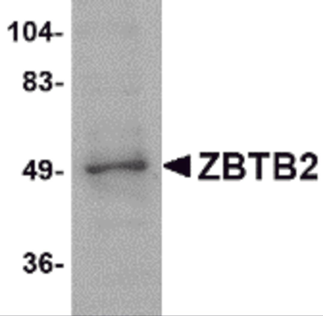 Western blot analysis of ZBTB2 in PC-3 cell lysate with ZBTB2 antibody at 1 μg/mL.