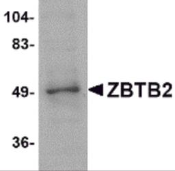 Western blot analysis of ZBTB2 in PC-3 cell lysate with ZBTB2 antibody at 1 μg/mL.