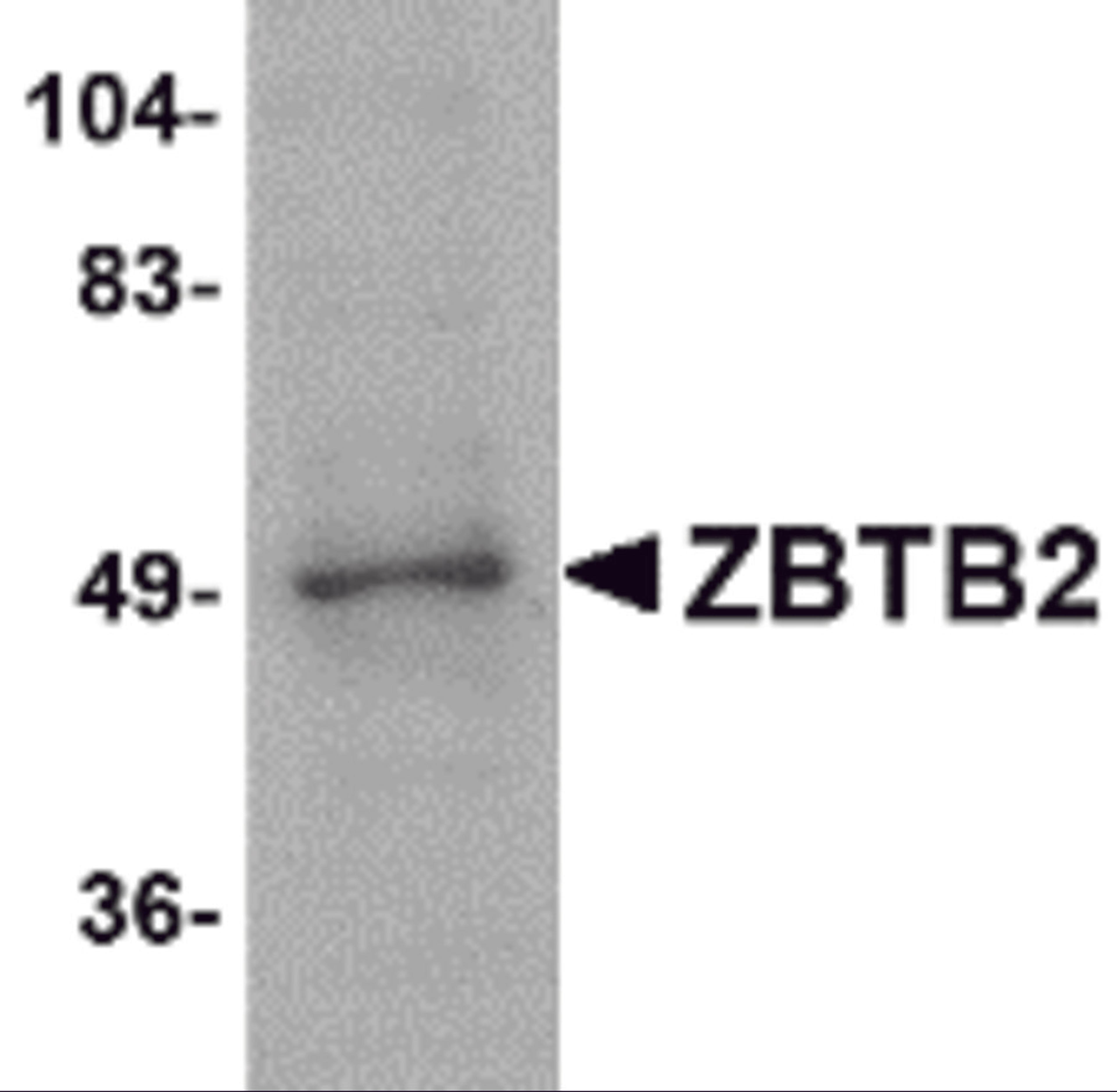 Western blot analysis of ZBTB2 in PC-3 cell lysate with ZBTB2 antibody at 1 μg/mL.