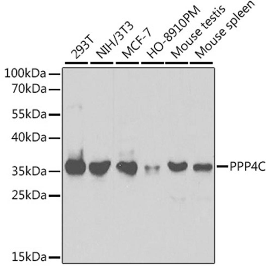 Western blot - PPP4C antibody (A2109)