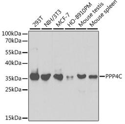 Western blot - PPP4C antibody (A2109)