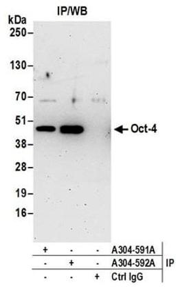 Detection of mouse Oct-4 by western blot of immunoprecipitates.