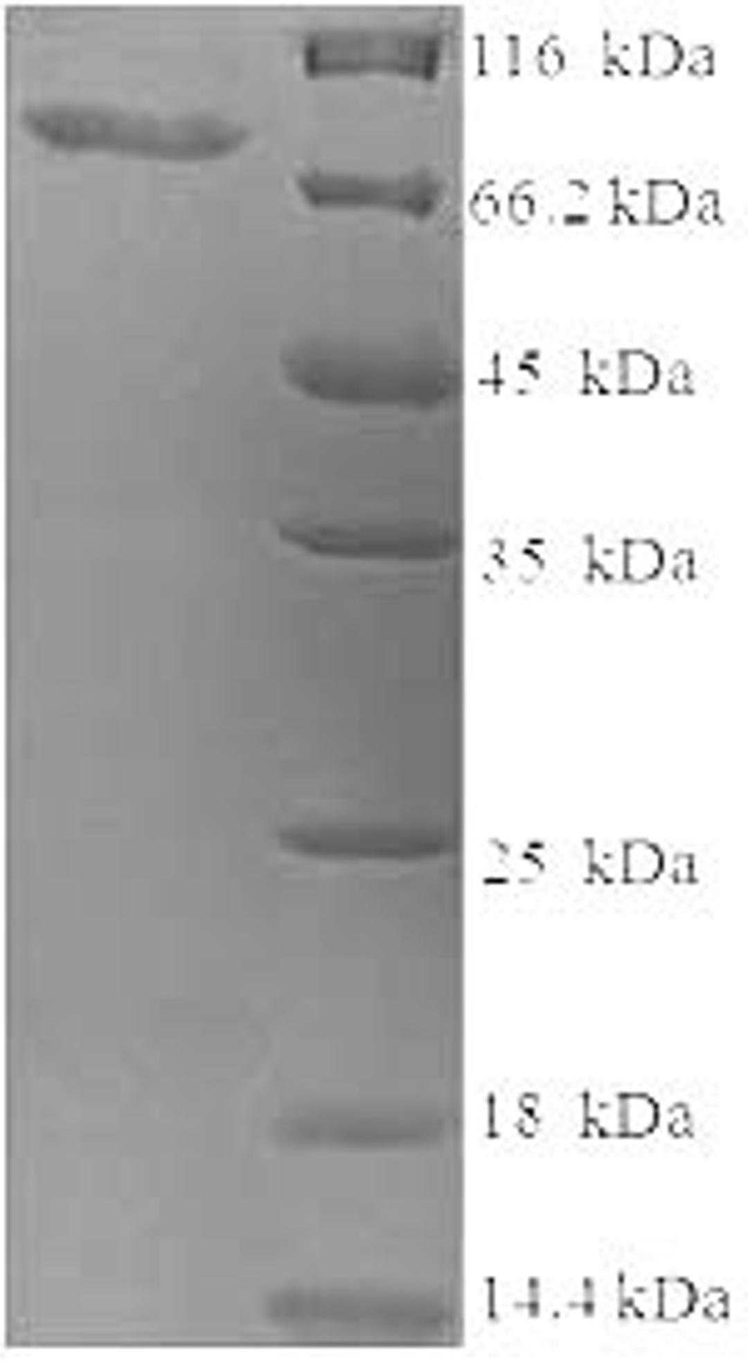 (Tris-Glycine gel) Discontinuous SDS-PAGE (reduced) with 5% enrichment gel and 15% separation gel.